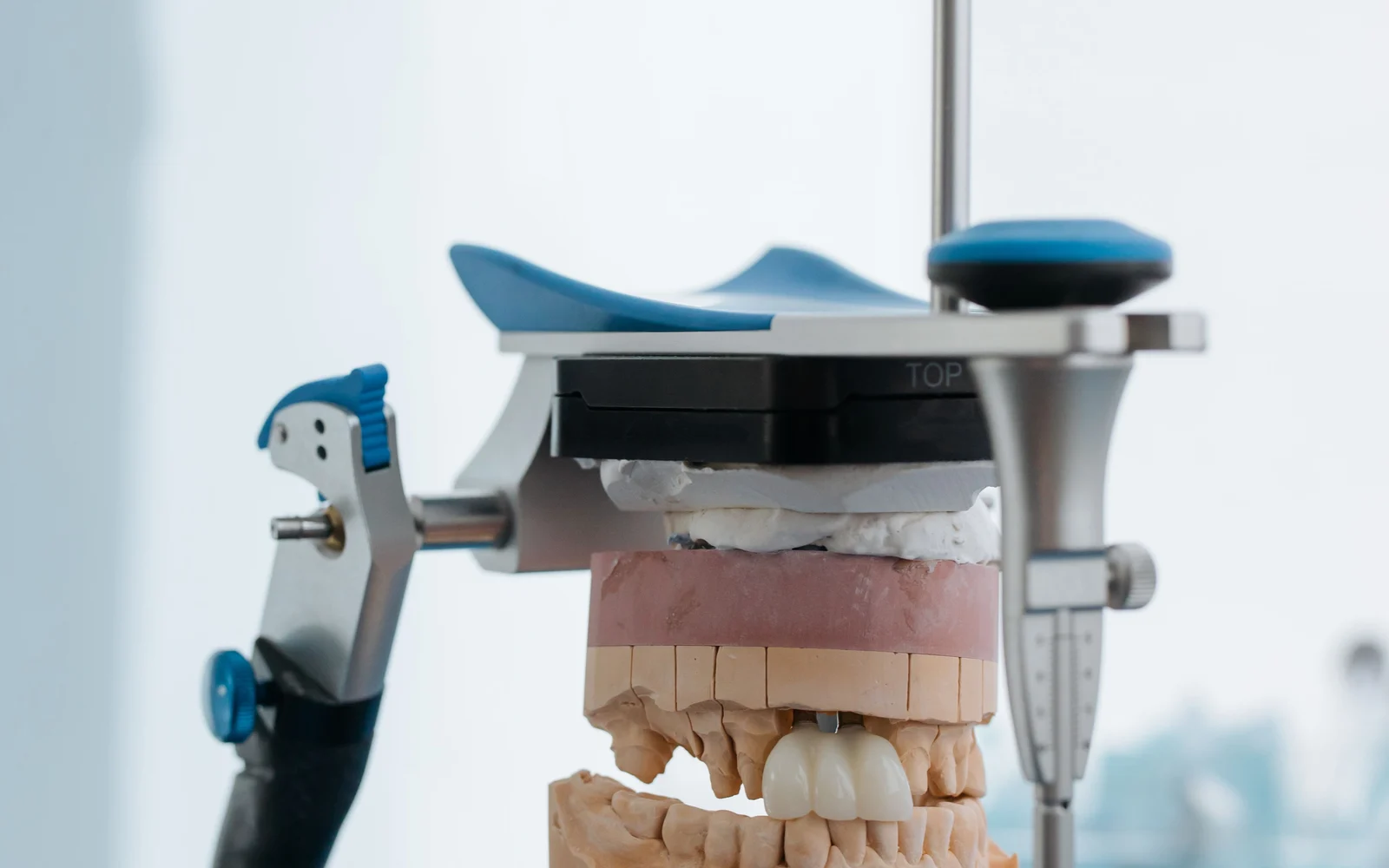 Dental prosthetic model mounted for crowns, bridges, and restorative planning.